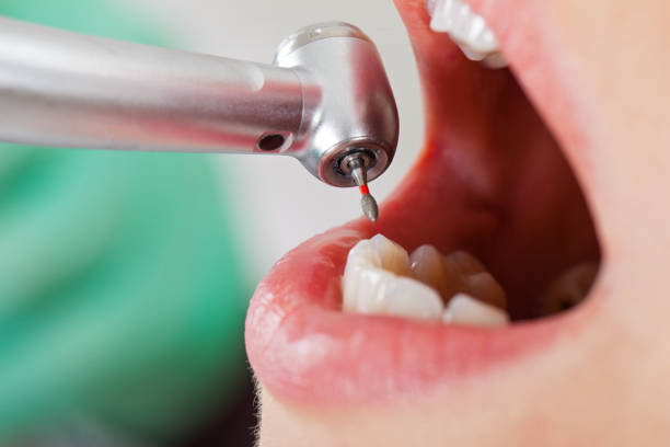 Best Emergency Treatment for Dental Infections or Abscesses in Shafer, MN